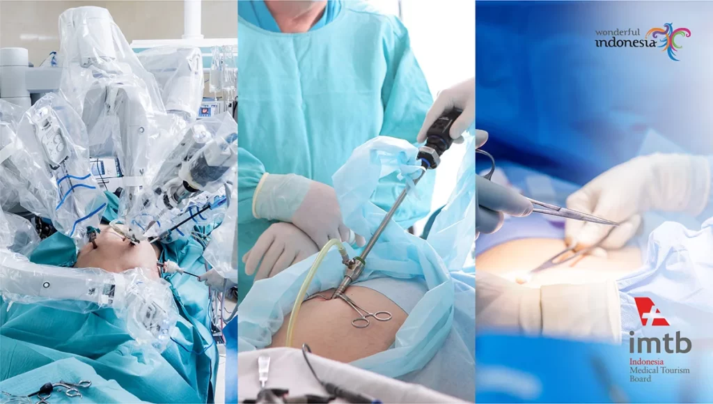 Apa Bedanya Robotic Surgery, Laparoskopi, dan Laparotomi
